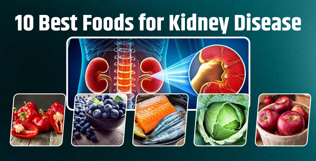 What are the 10 best foods for kidney disease